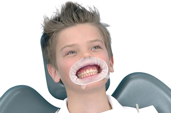 OptraGate Junior Hvit 80stk