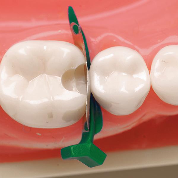 FenderMate Venstre Regular 18stk