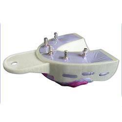 Miratray Implant S2 Medium OK 6stk