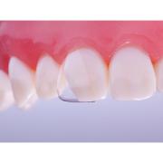 CoForm Sentral 11 Mesial 4x2stk