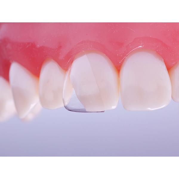 CoForm Sentral 11 Mesial 4x2stk
