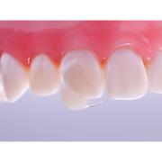 CoForm Sentral 11 Mesial 4x2stk