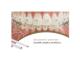 FO 217-2140 Titanol Biocosmetic .016X.022 ukj Coated