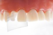 ProxyPal 3D Matriser Directa 36stk